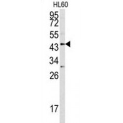 Asporin (ASPN) Antibody