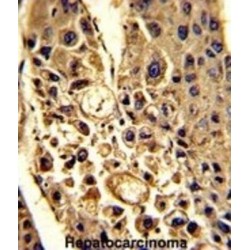 Complement Factor H-Related Protein 1 (CFHL1) Antibody