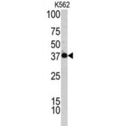 Complement Factor H-Related Protein 1 (CFHL1) Antibody