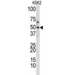 Transforming Growth Factor-Beta-Inducible Early Growth Response Protein 2 (TIEG2) Antibody
