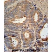 Zinc-Alpha-2-Glycoprotein (AZGP1) Antibody