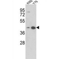 Zinc-Alpha-2-Glycoprotein (AZGP1) Antibody