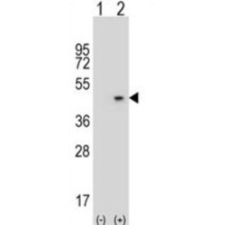 Zinc-Alpha-2-Glycoprotein (AZGP1) Antibody