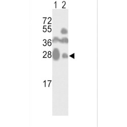 Cluster of Differentiation 81 (CD81) Antibody