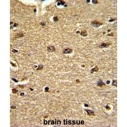 Clusterin Associated Protein 1 (CLUAP1) Antibody