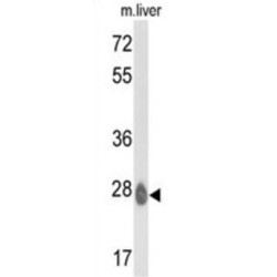 Ethylmalonic Encephalopathy 1 (ETHE1) Antibody