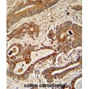 Ethylmalonic Encephalopathy 1 (ETHE1) Antibody