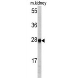 Ethylmalonic Encephalopathy 1 (ETHE1) Antibody