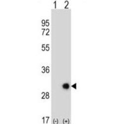 Ethylmalonic Encephalopathy 1 (ETHE1) Antibody