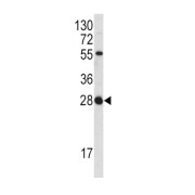 Fibroblast Growth Factor 18 (FGF18) Antibody