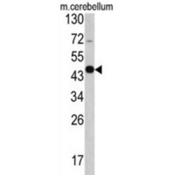 Growth Arrest Specific Protein 7 (GAS7) Antibody