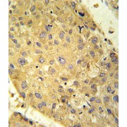 Glutaminase Liver Isoform, Mitochondrial (GLS2) Antibody