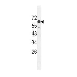 Glutaminase Liver Isoform, Mitochondrial (GLS2) Antibody