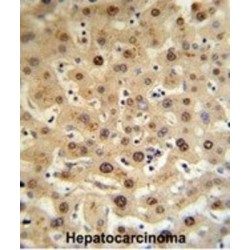 Hemopexin (HPX) Antibody