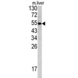 Hemopexin (HPX) Antibody