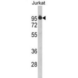 HIV TAT Specific Factor 1 (HTATSF1) Antibody