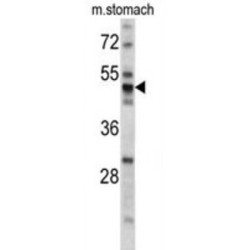 Protein Disulfide Isomerase A6 (PDIA6) Antibody