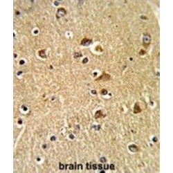 Protein Disulfide Isomerase A6 (PDIA6) Antibody