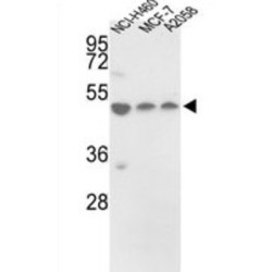 Protein Disulfide Isomerase A6 (PDIA6) Antibody