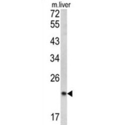 Signal Peptidase Complex Subunit 3 (SPCS3) Antibody