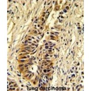 Transaldolase (TALDO1) Antibody