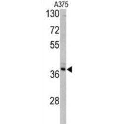 Transaldolase (TALDO1) Antibody