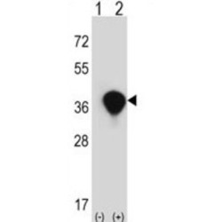 Transaldolase (TALDO1) Antibody