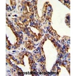 Tumor-Associated Calcium Signal Transducer 2 (TROP2) Antibody