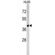 WB analysis of HL60 cell line lysates