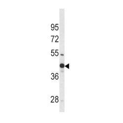 Protein Wnt-4 (WNT4) Antibody