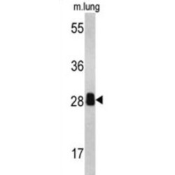 Proteasome Activator Complex Subunit 2 (PSME2) Antibody