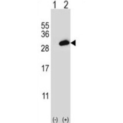 Proteasome Activator Complex Subunit 2 (PSME2) Antibody