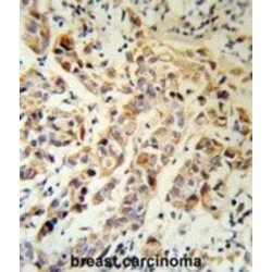 Keratin 13 (KRT13) Antibody