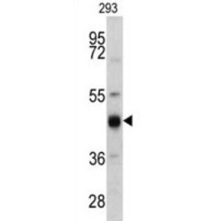 Keratin 13 (KRT13) Antibody