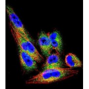 Metalloproteinase Inhibitor 1 (TIMP1) Antibody