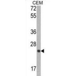 Metalloproteinase Inhibitor 1 (TIMP1) Antibody