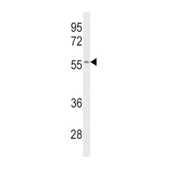 Cytochrome P450 2C19 (CYP2C19) Antibody