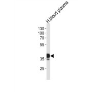 Thyroxine Binding Globulin / TBG (SERPINA7) Antibody