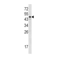 Thyroxine Binding Globulin / TBG (SERPINA7) Antibody