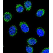 Antithrombin-III (SERPINC1) Antibody