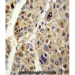 Antithrombin-III (SERPINC1) Antibody