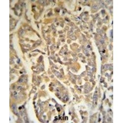 Dermcidin (DCD) Antibody