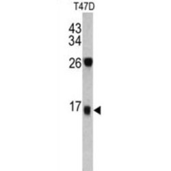 Dermcidin (DCD) Antibody