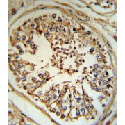 Inhibin Alpha (INHA) Antibody