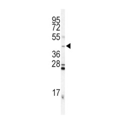 Inhibin Alpha (INHA) Antibody