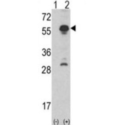 Inhibin Alpha (INHA) Antibody