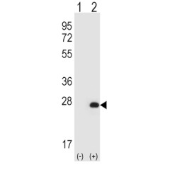 Hypoxanthine Phosphoribosyltransferase 1 (HPRT1) Antibody