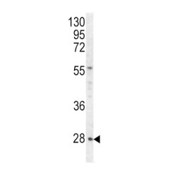 Hypoxanthine Phosphoribosyltransferase 1 (HPRT1) Antibody