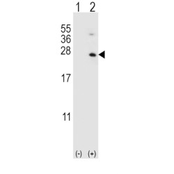 Hypoxanthine Phosphoribosyltransferase 1 (HPRT1) Antibody