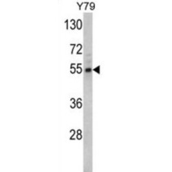 Fascin (FSCN1) Antibody